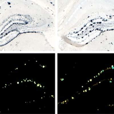 Illuminating the structure of amyloid plaques.